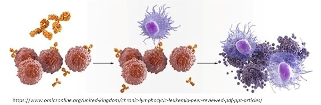 leukemia