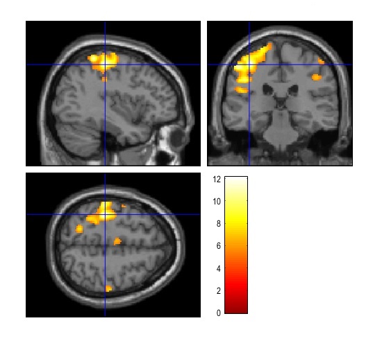 fmri